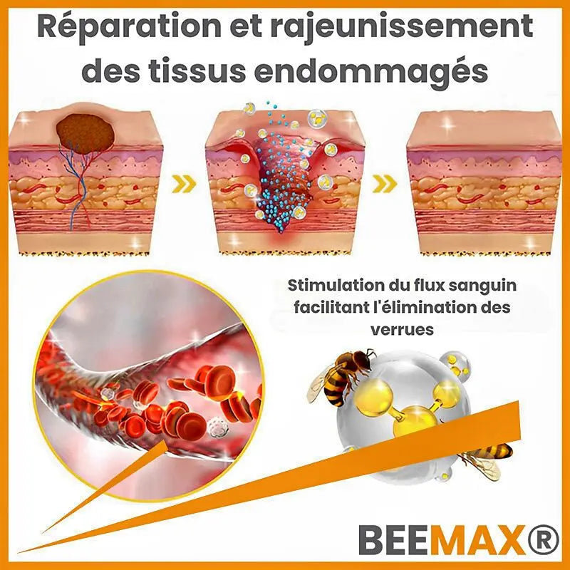 Éliminez Vos Imperfections de Peau en 5 Jours - Spray au Venin d'Abeille, Naturel et Efficace, Testé Dermatologiquement