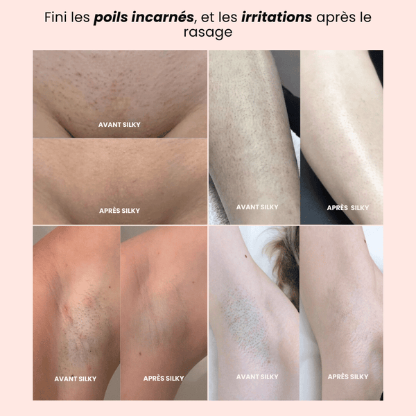 Tondeuse Rasoir 2.0