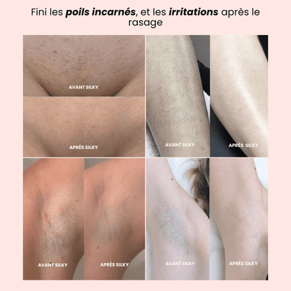 Tondeuse Rasoir 2.0